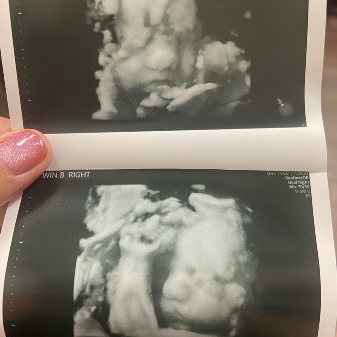 Photo shared by Emily for their Babylist baby registry.