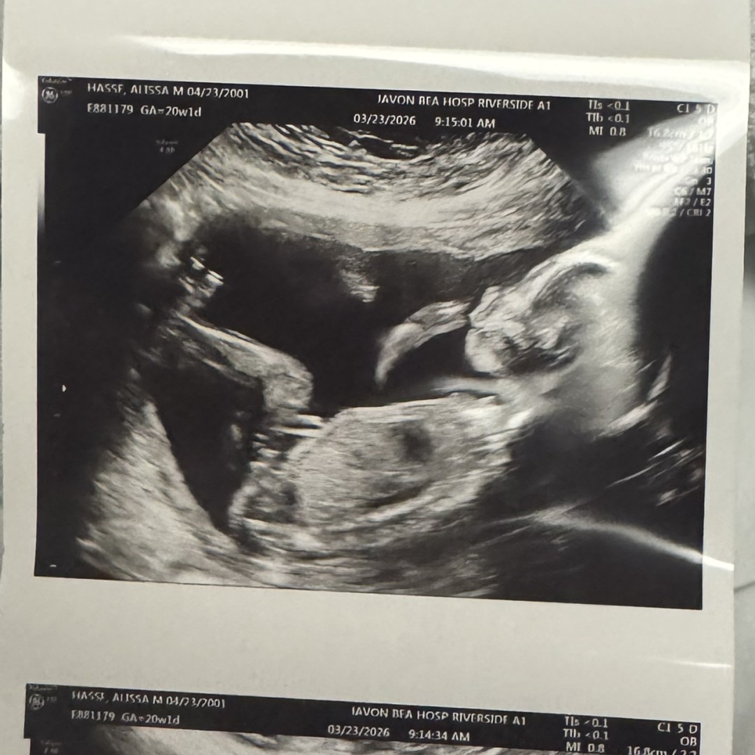 Photo shared by Alissa for their Babylist baby registry.