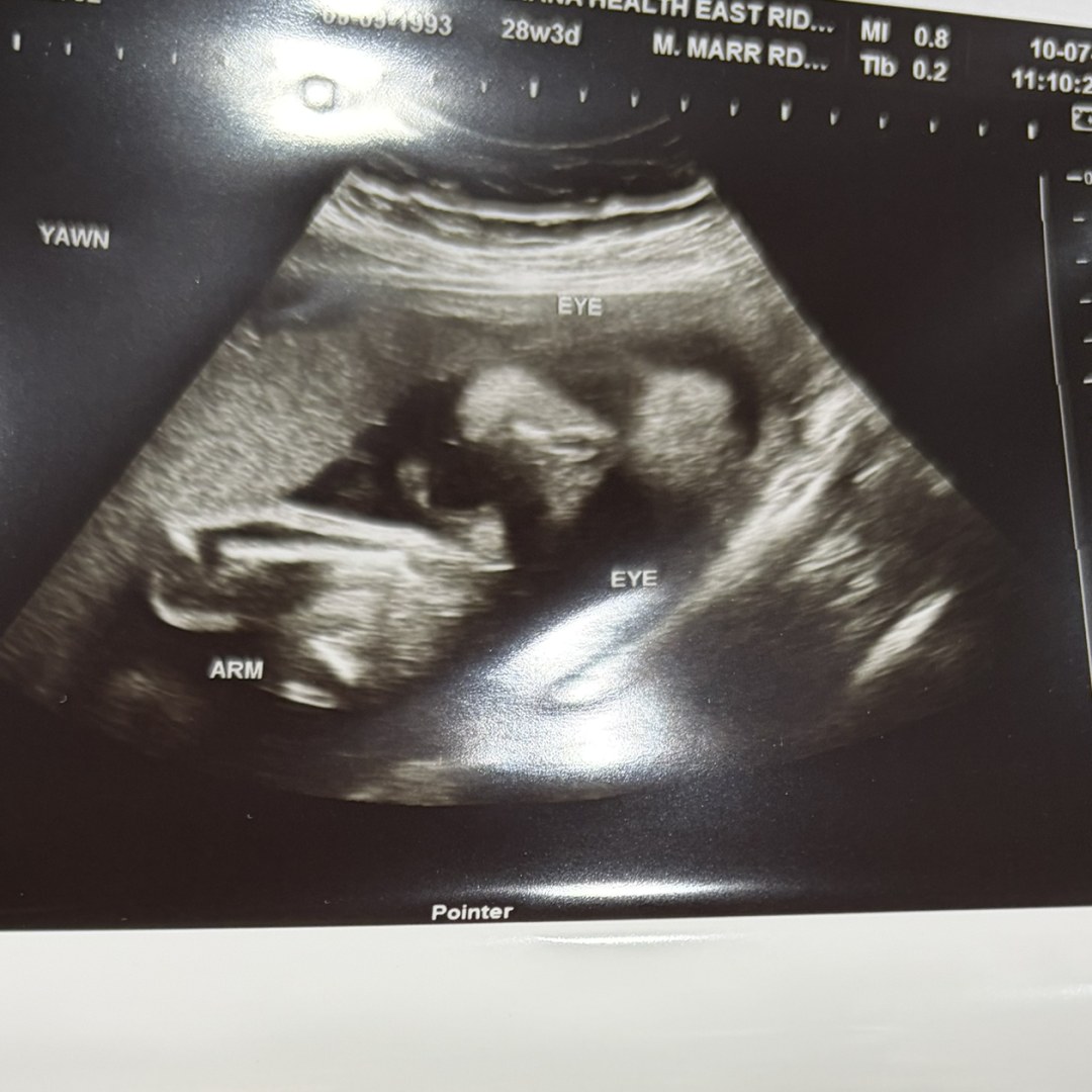 Photo shared by Ashley for their Babylist baby registry.