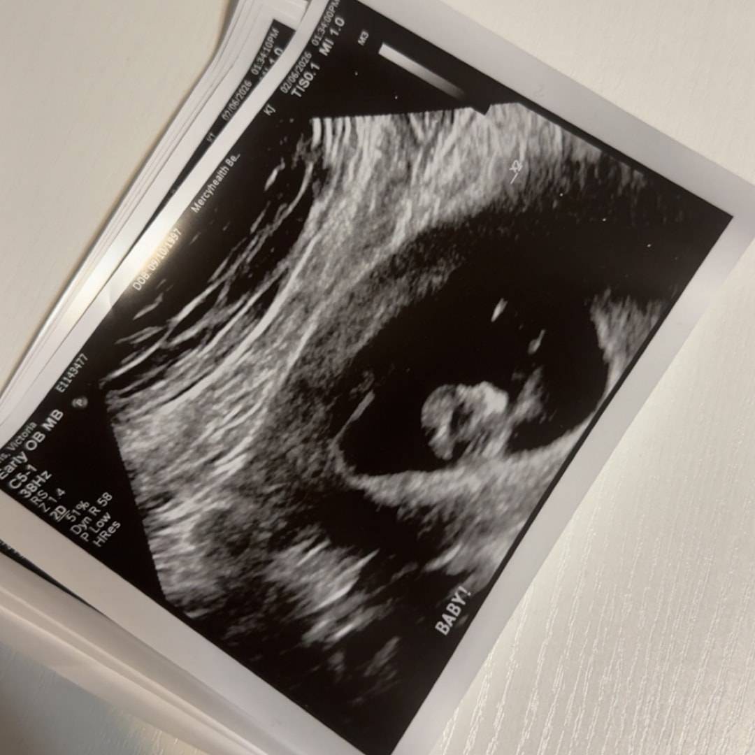 Photo shared by Victoria for their Babylist baby registry.