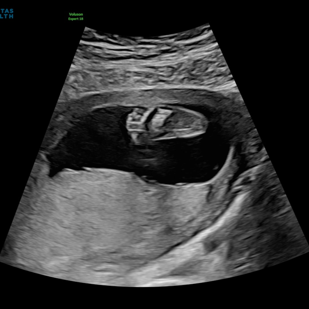 Photo shared by Gracyn for their Babylist baby registry.