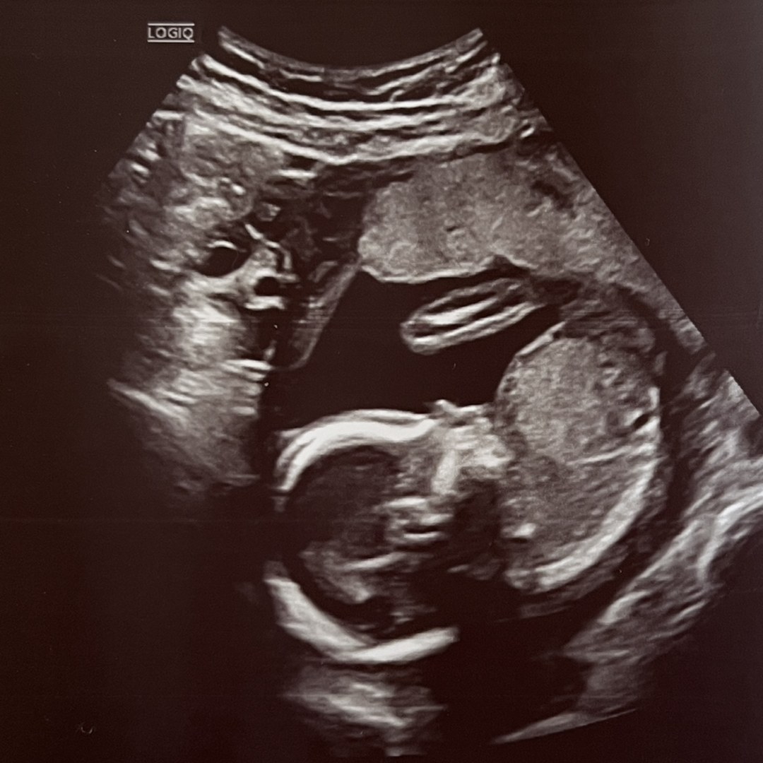 Photo shared by Anina for their Babylist baby registry.