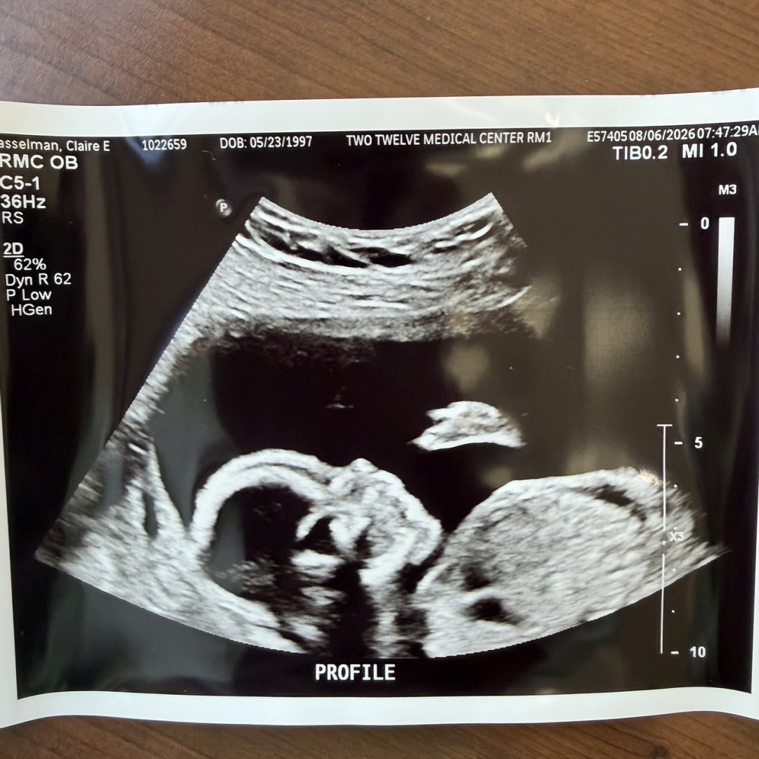 Photo shared by Claire for their Babylist baby registry.