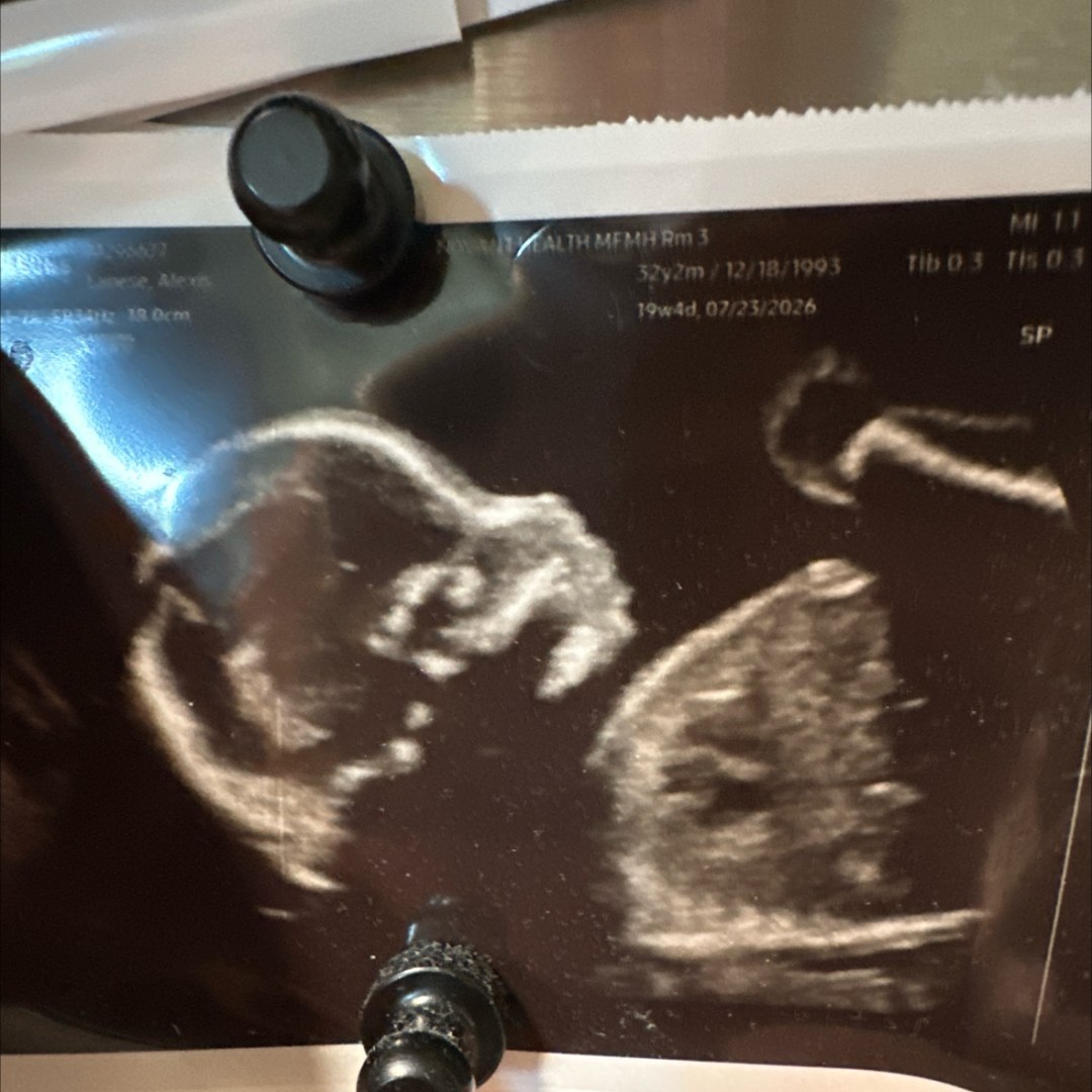 Photo shared by Alexis for their Babylist baby registry.