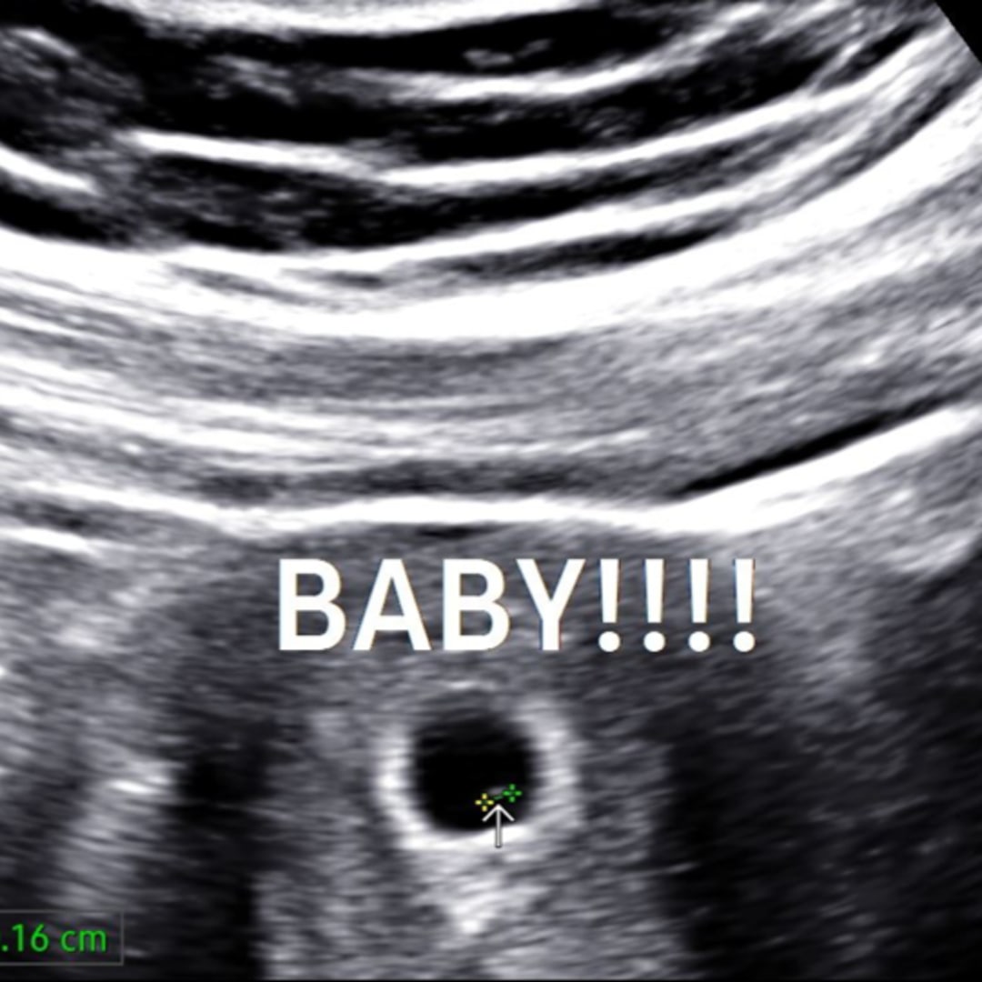 Photo shared by Allyson for their Babylist baby registry.