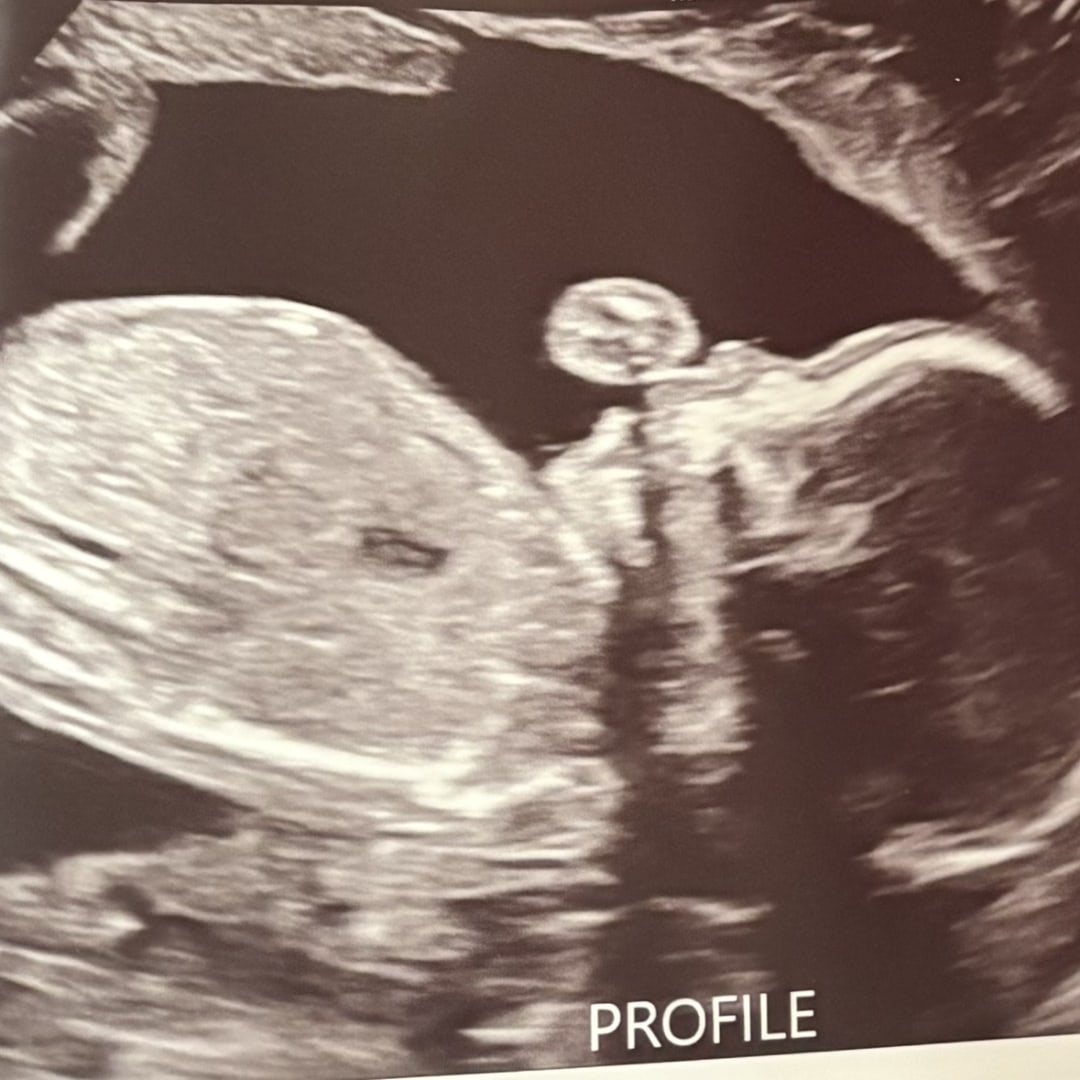Photo shared by Hallie for their Babylist baby registry.