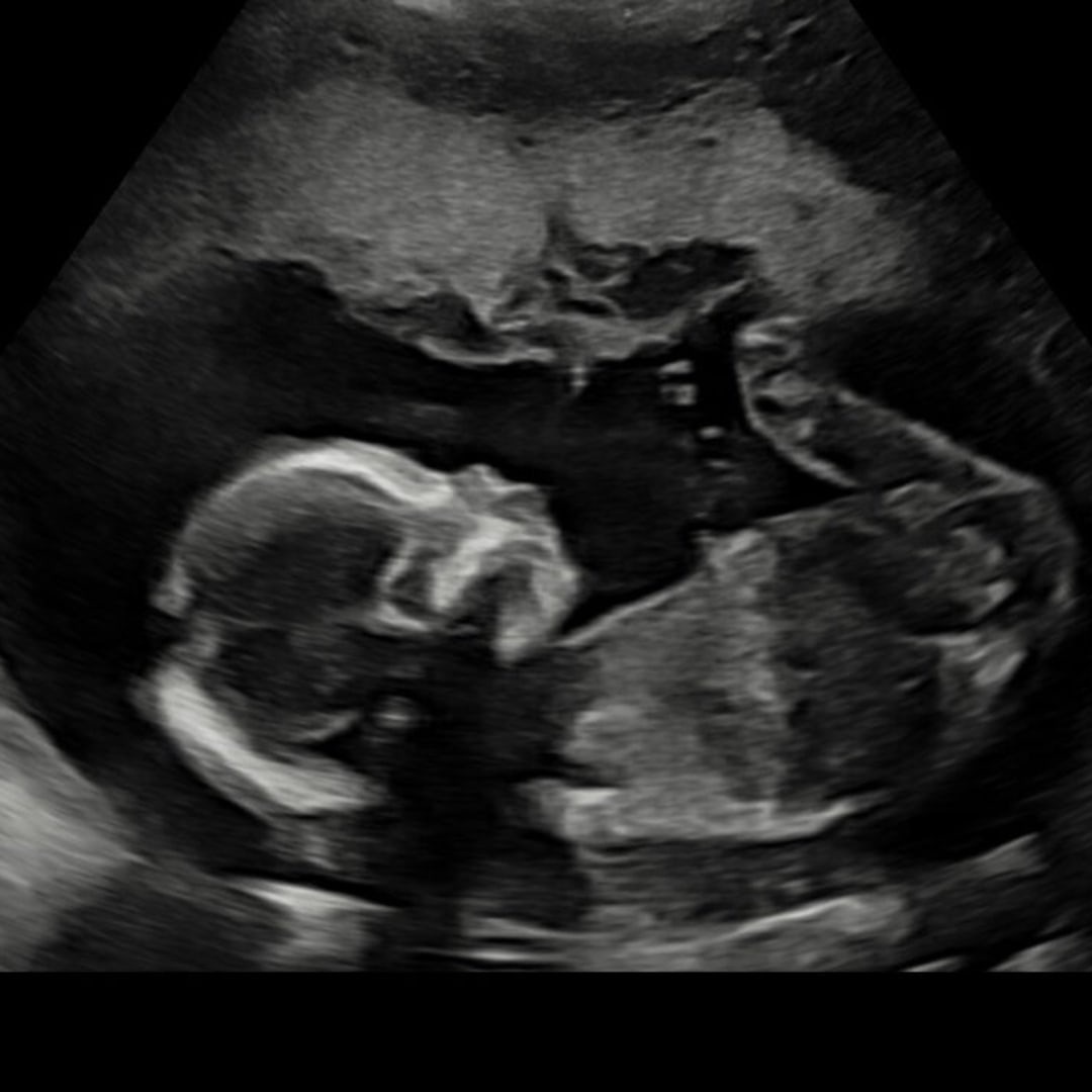 Photo shared by Candace for their Babylist baby registry.