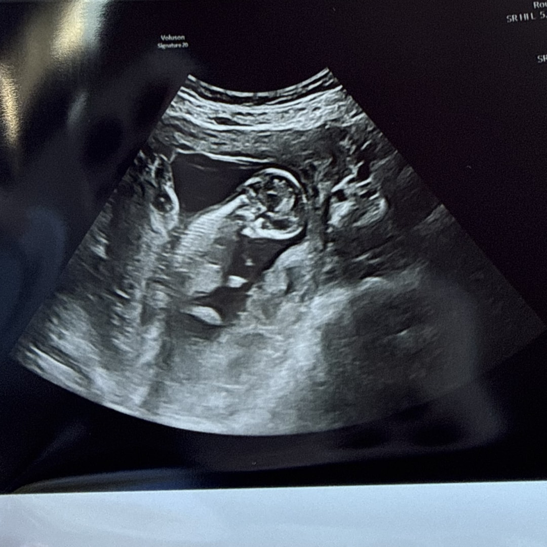 Photo shared by Kaitlyn for their Babylist baby registry.