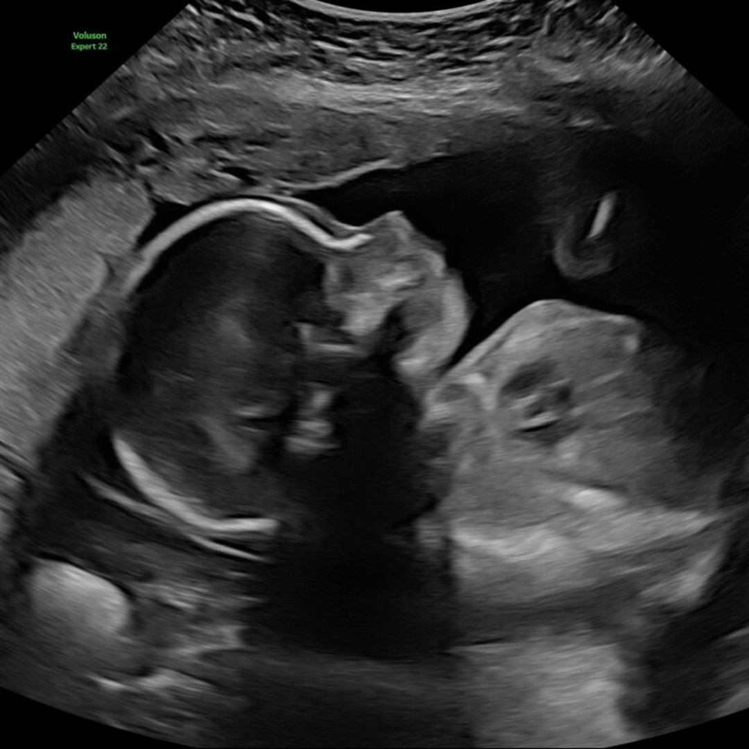 Photo shared by Cesiah for their Babylist baby registry.