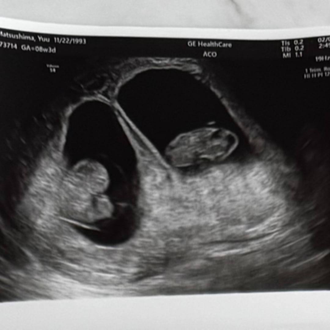 Photo shared by Andrew for their Babylist baby registry.