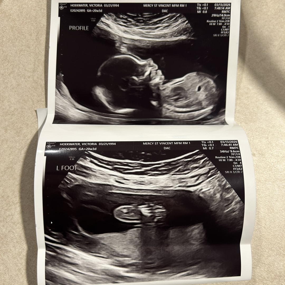Photo shared by Victoria for their Babylist baby registry.