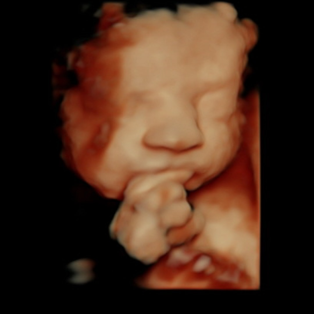 Photo shared by McKenna for their Babylist baby registry.