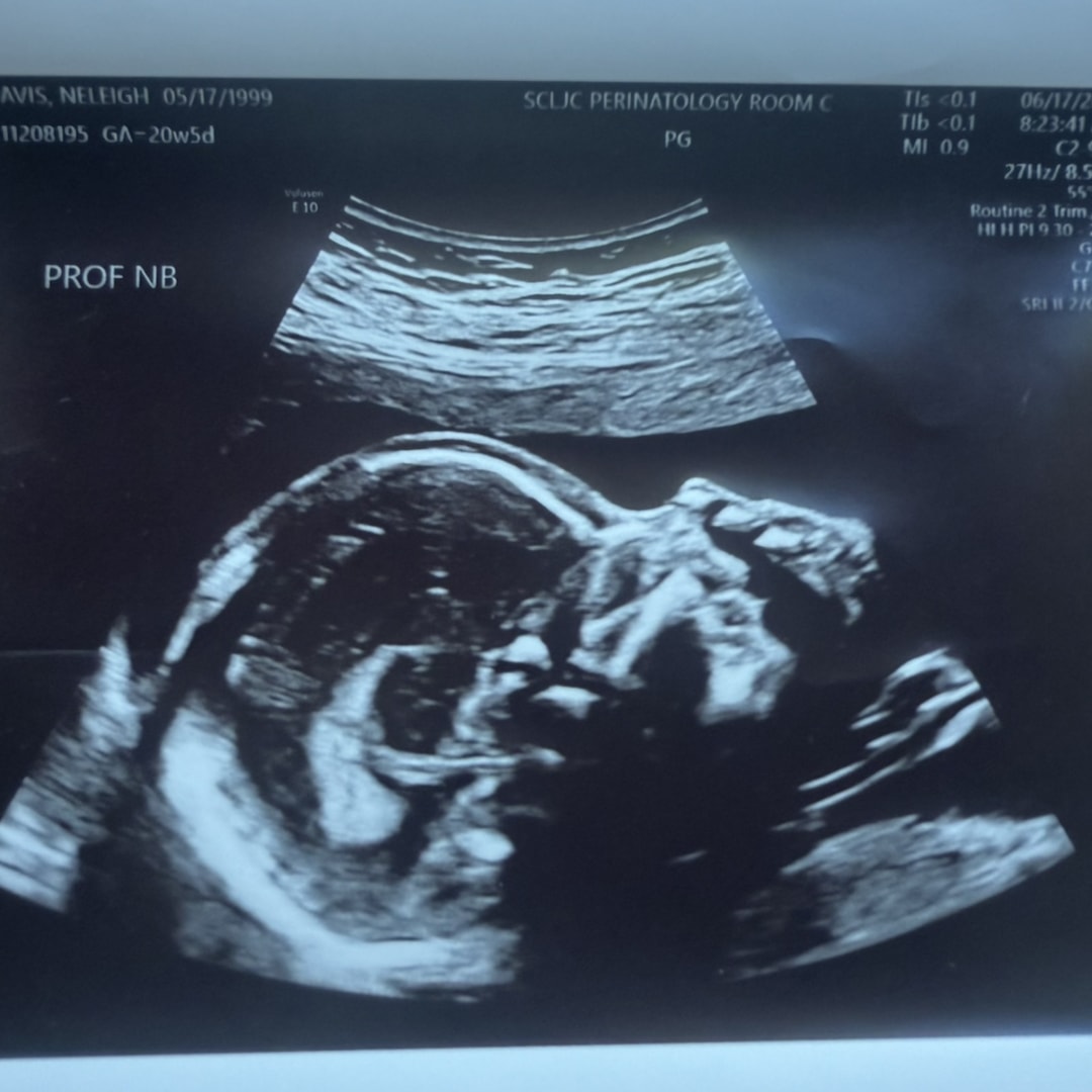 Photo shared by Neleigh for their Babylist baby registry.