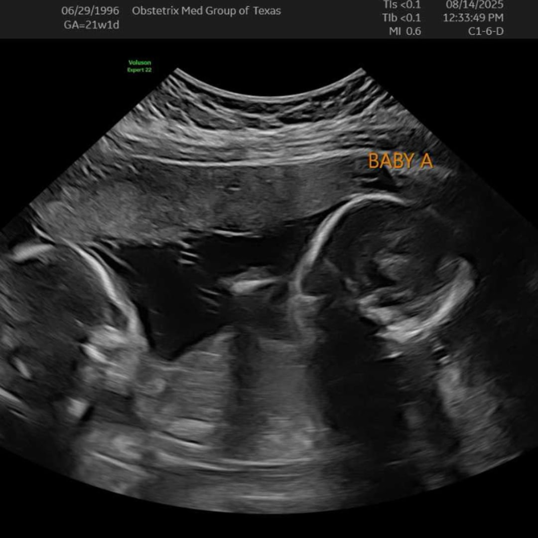 Photo shared by Allyssa for their Babylist baby registry.