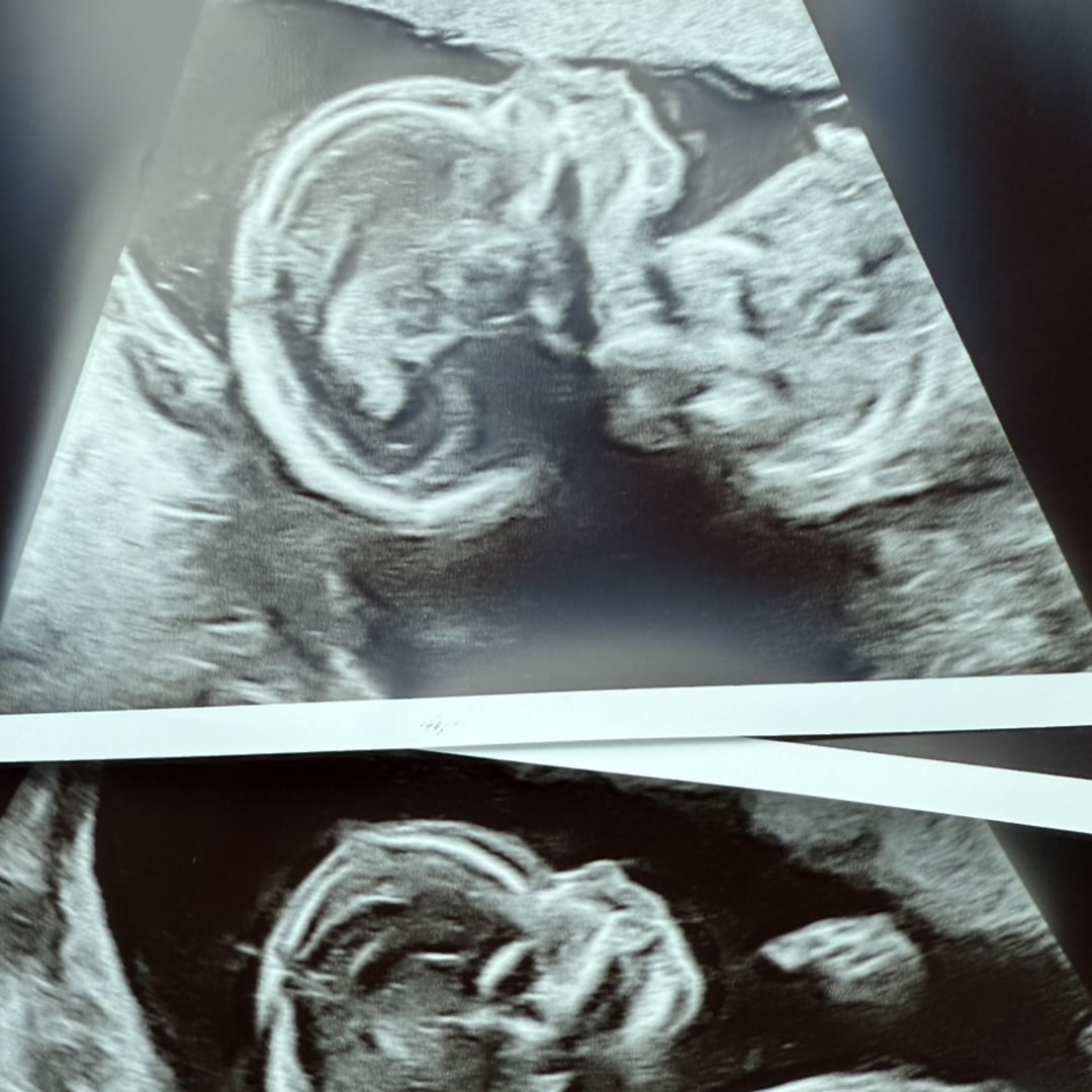 Photo shared by Miranda for their Babylist baby registry.