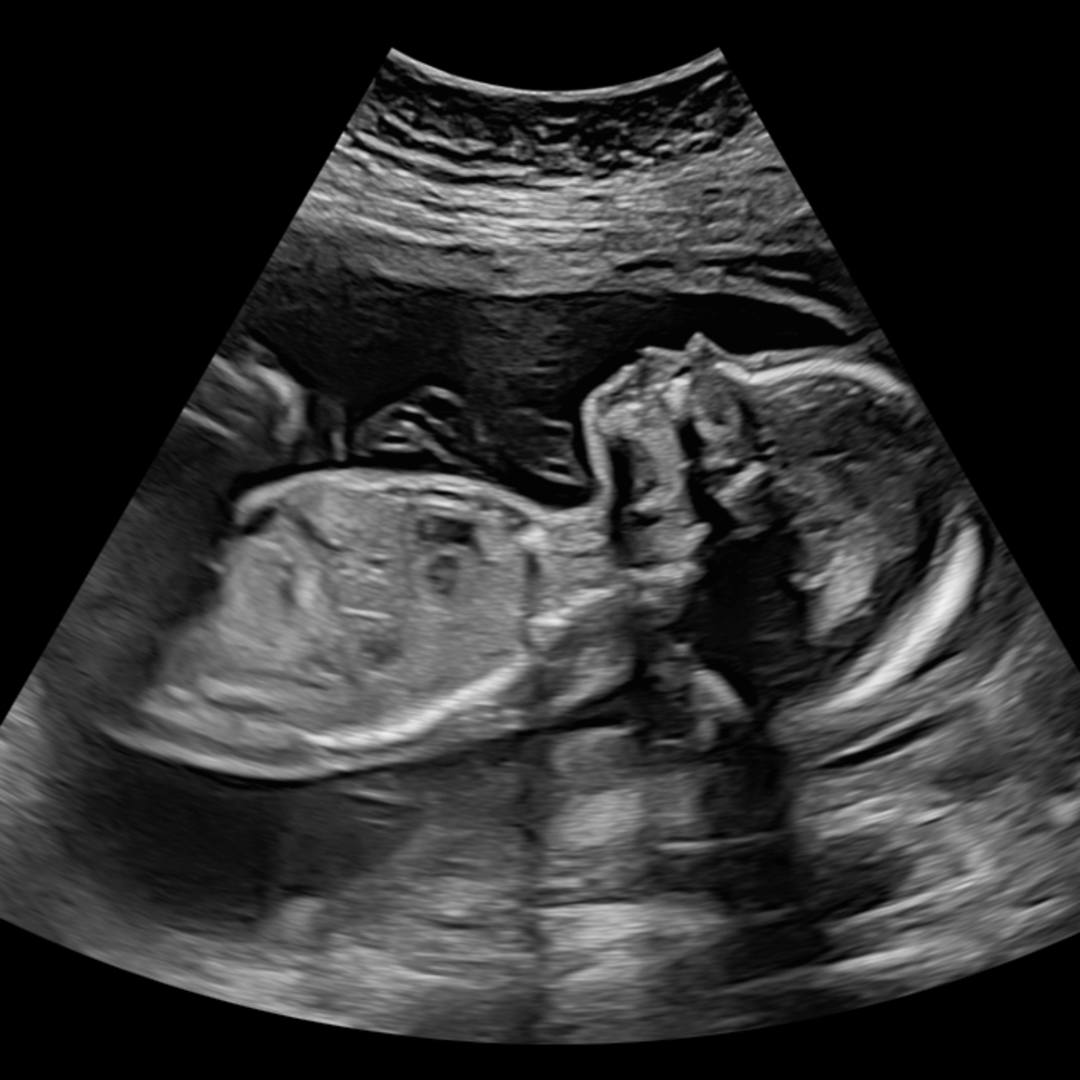 Photo shared by Julie for their Babylist baby registry.