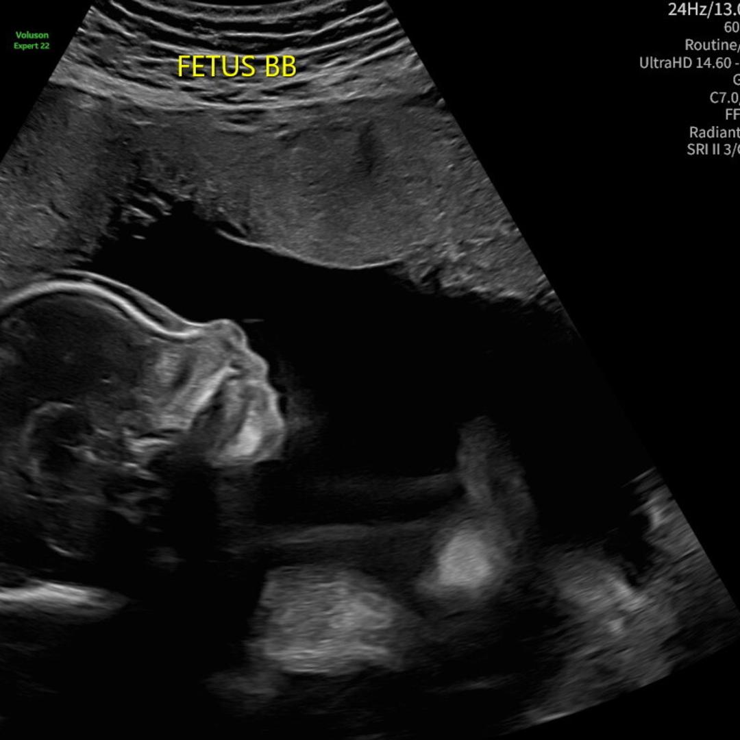 Photo shared by Cyreil for their Babylist baby registry.