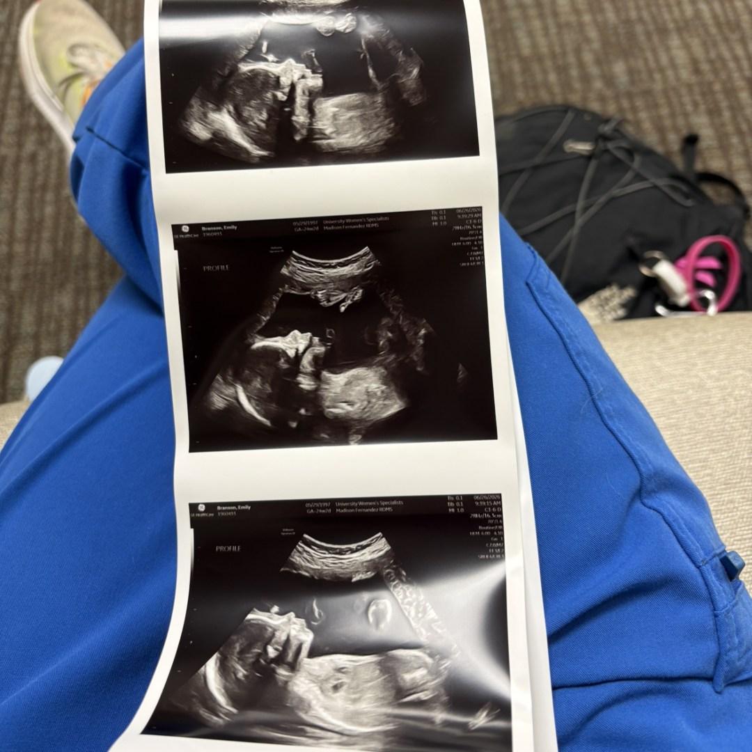 Photo shared by Emily for their Babylist baby registry.