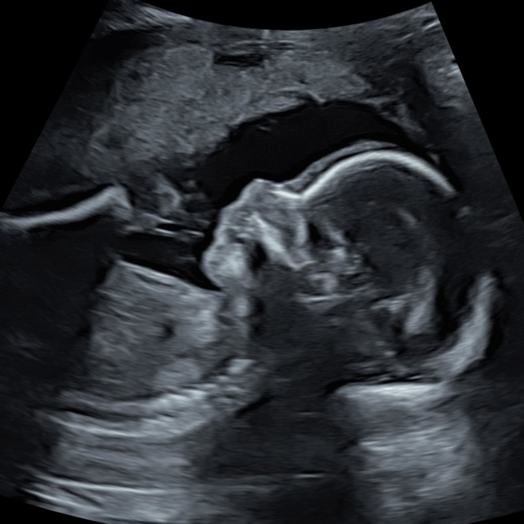 Photo shared by Alma for their Babylist baby registry.