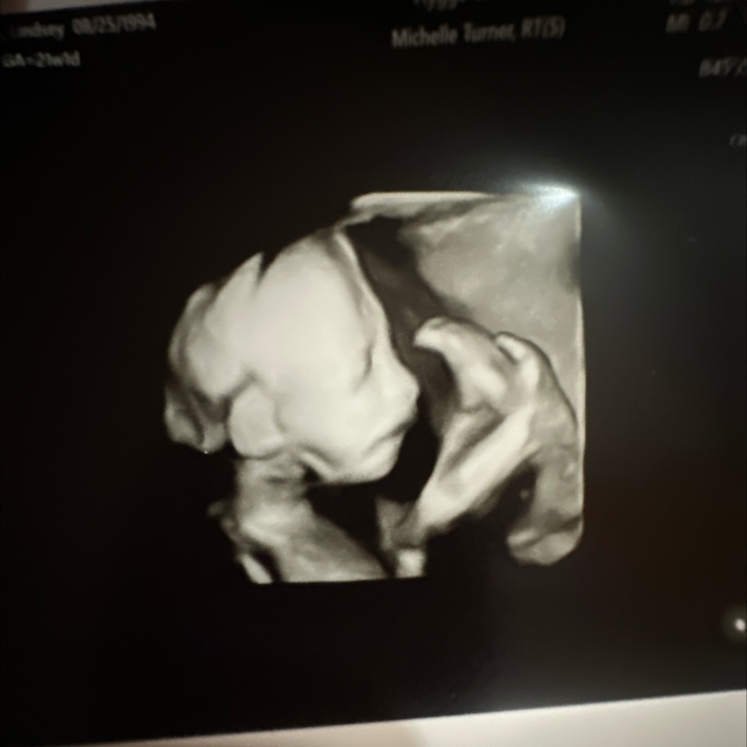 Photo shared by Lindsey for their Babylist baby registry.
