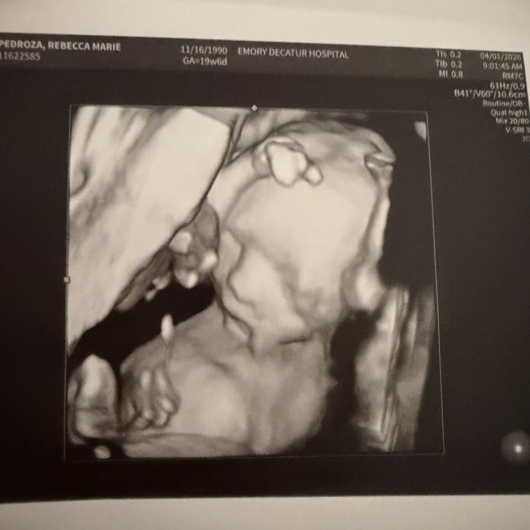 Photo shared by Rebecca for their Babylist baby registry.