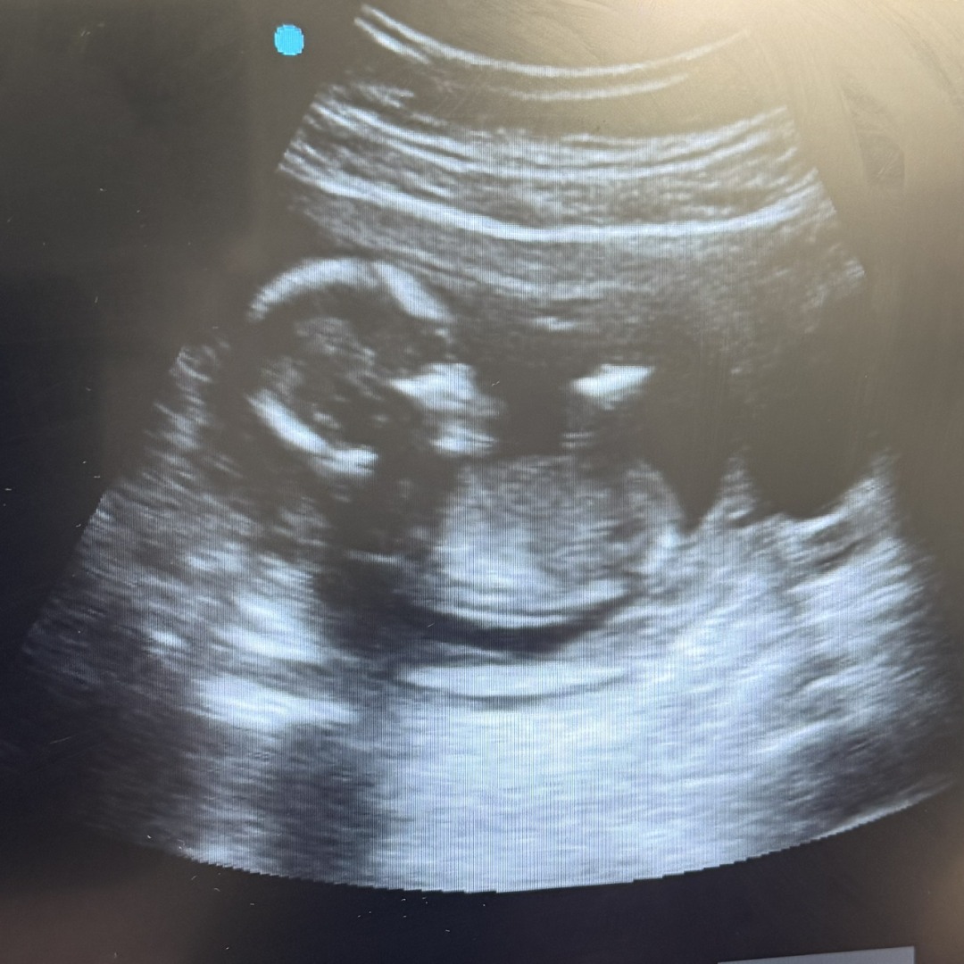 Photo shared by Nhilze for their Babylist baby registry.