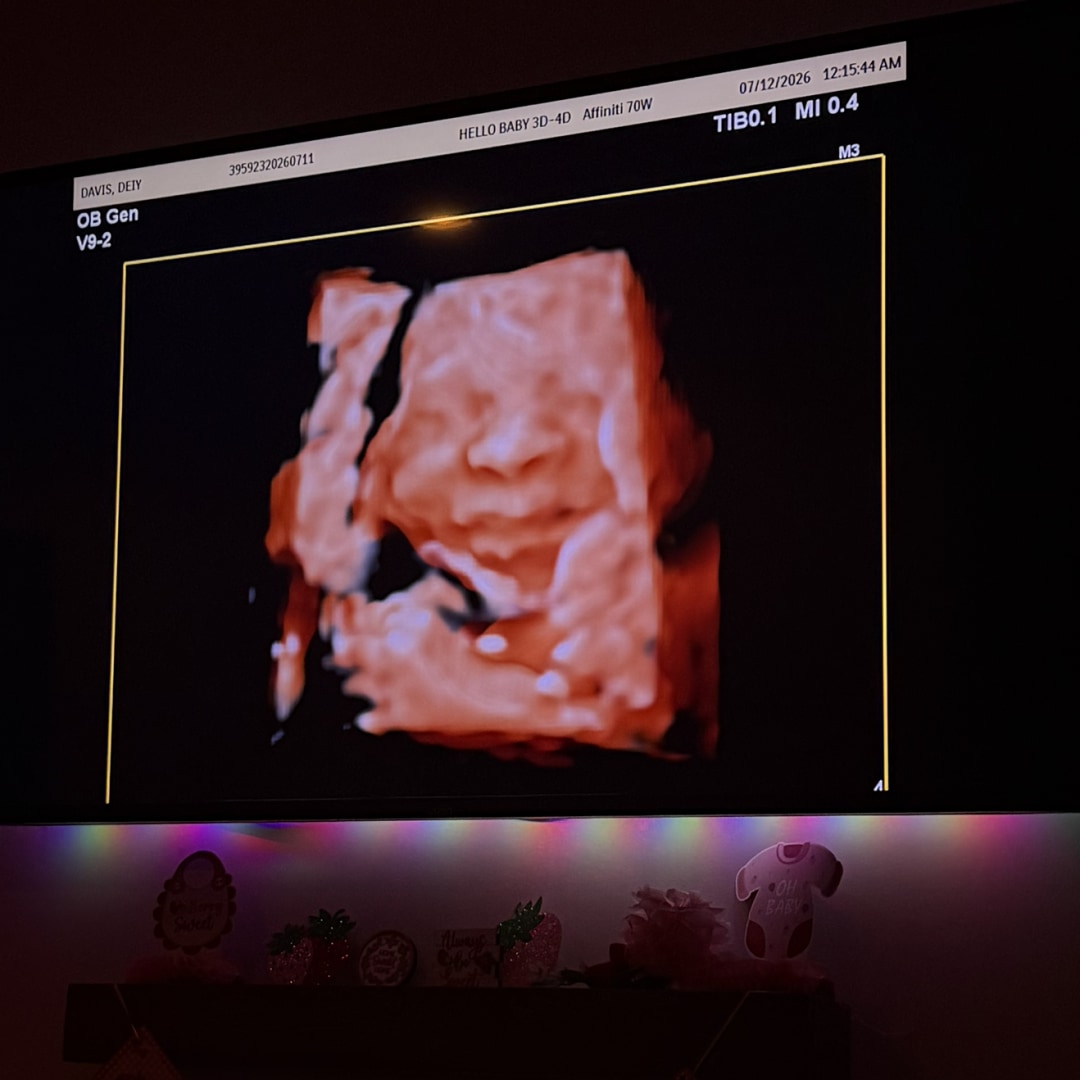 Photo shared by Deiy for their Babylist baby registry.