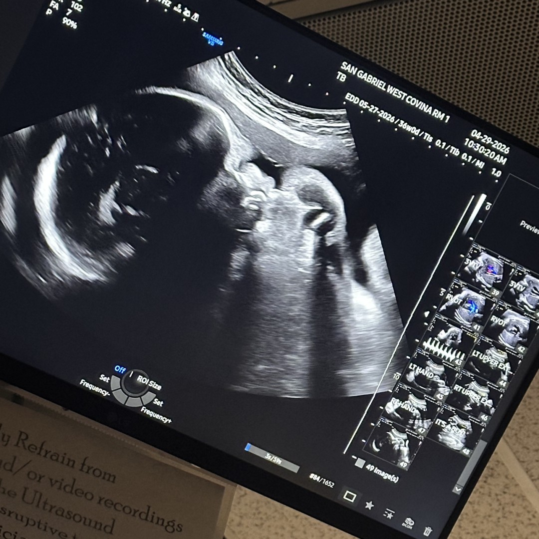 Photo shared by Haizhu for their Babylist baby registry.