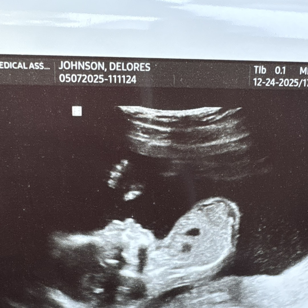 Photo shared by Delores for their Babylist baby registry.