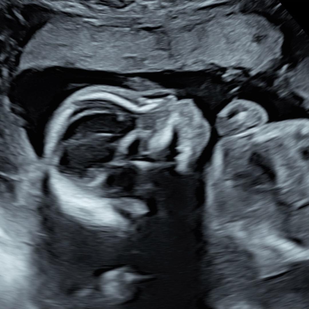Photo shared by Amy for their Babylist baby registry.