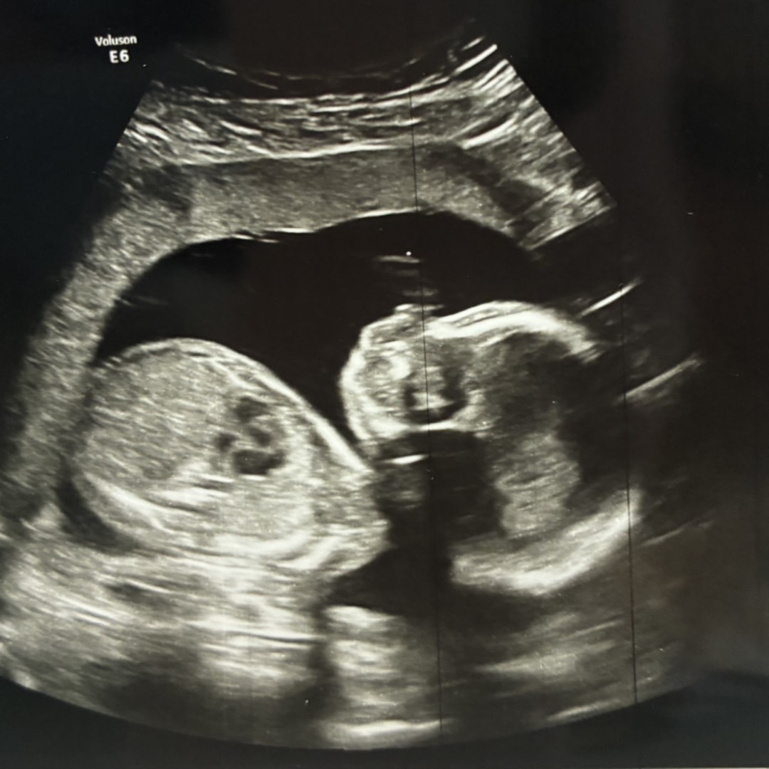 Photo shared by Gina for their Babylist baby registry.