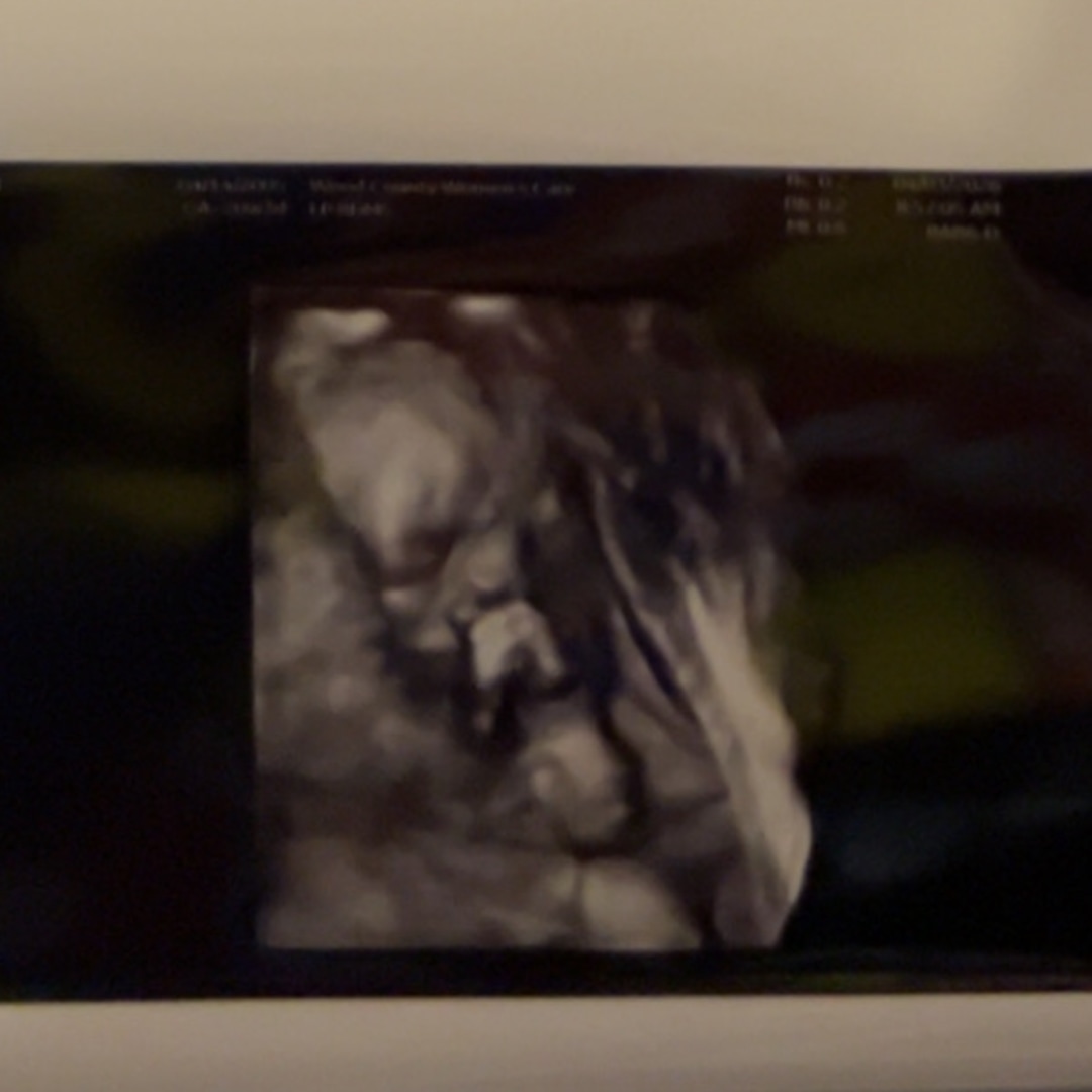 Photo shared by Lilly for their Babylist baby registry.