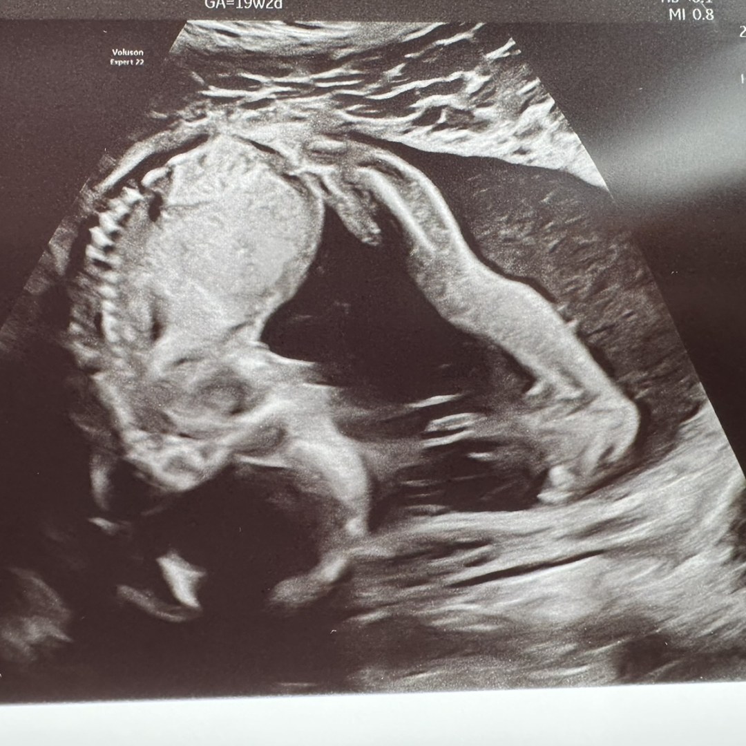 Photo shared by Ashley for their Babylist baby registry.