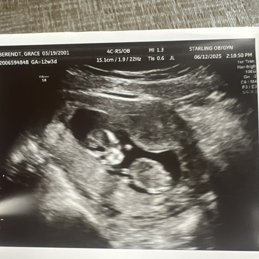 Photo shared by Grace for their Babylist baby registry.