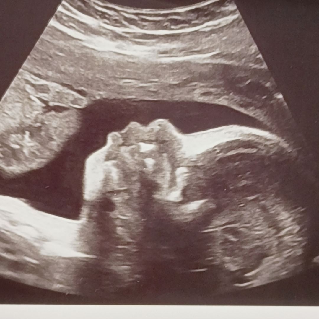 Photo shared by Jada for their Babylist baby registry.