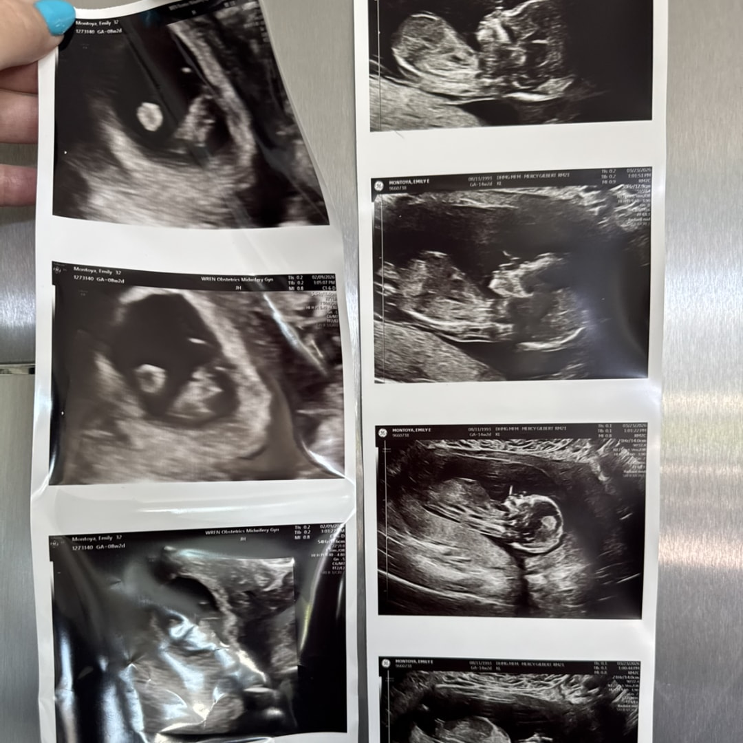 Photo shared by Emily for their Babylist baby registry.