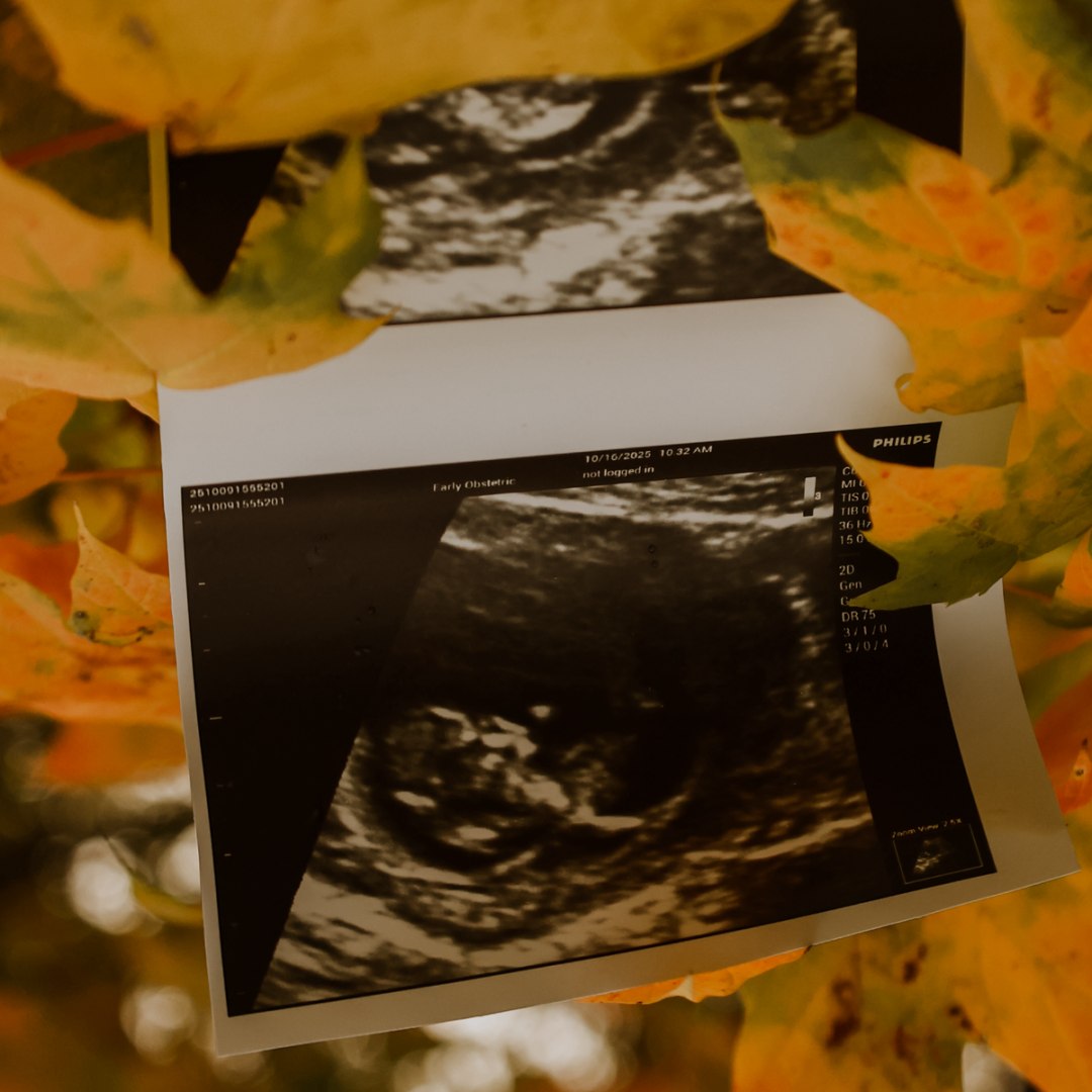 Photo shared by Katelyn for their Babylist baby registry.