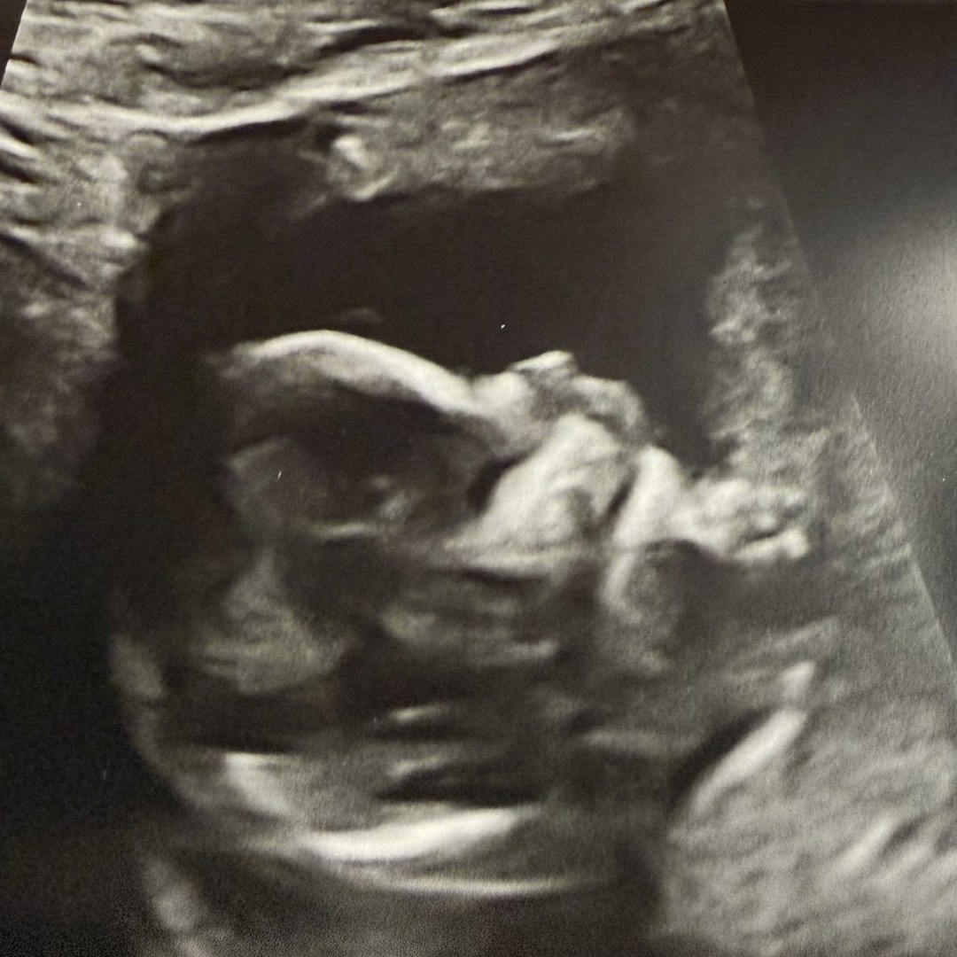 Photo shared by Elizabeth for their Babylist baby registry.