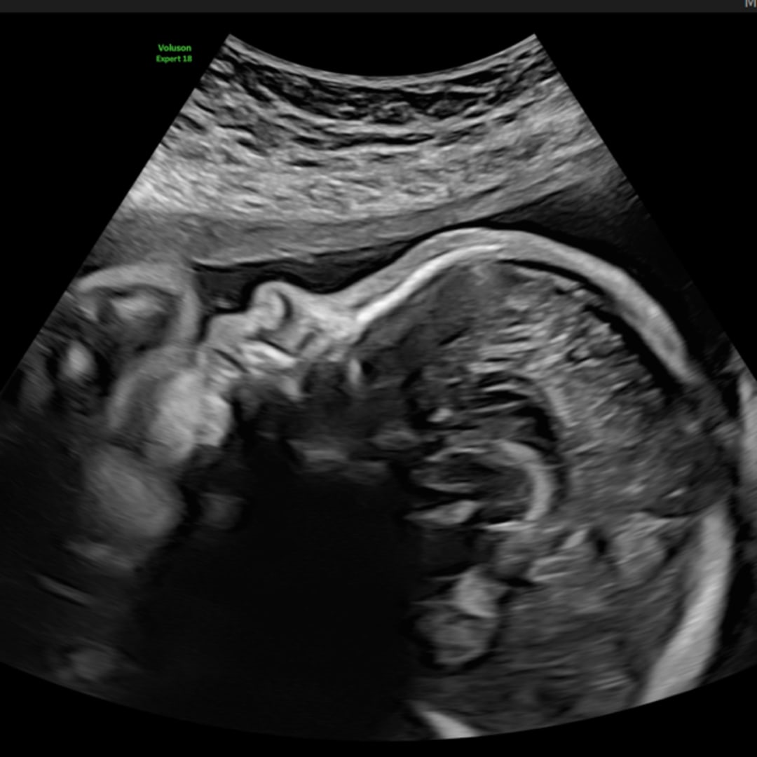 Photo shared by Brayden for their Babylist baby registry.