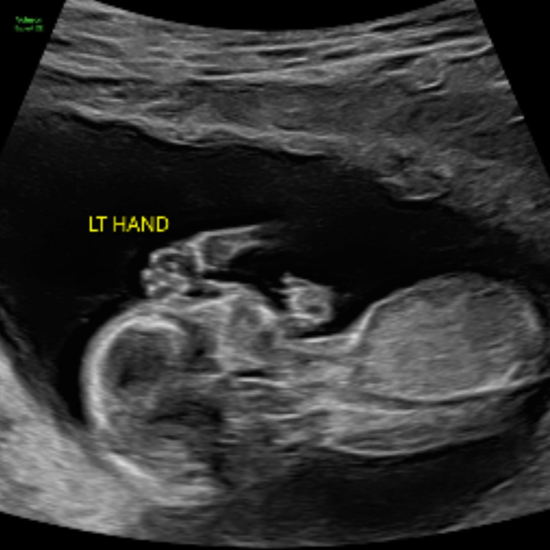 Photo shared by Gulay for their Babylist baby registry.