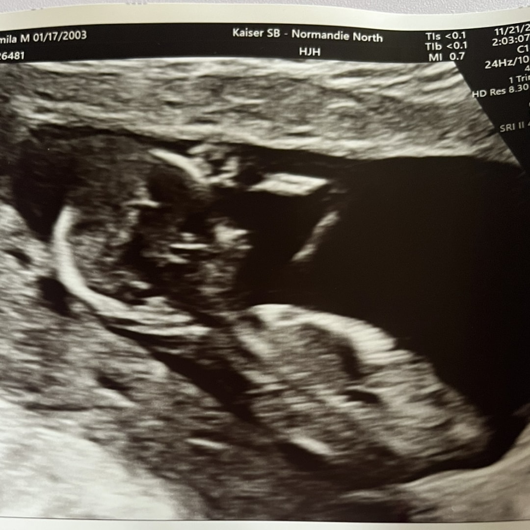 Photo shared by Yamila for their Babylist baby registry.