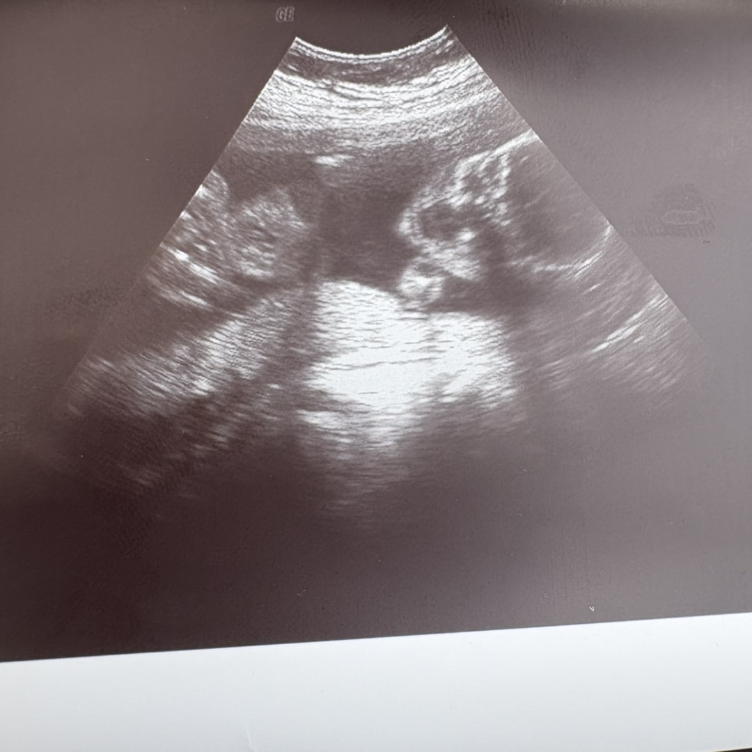 Photo shared by Taryn for their Babylist baby registry.