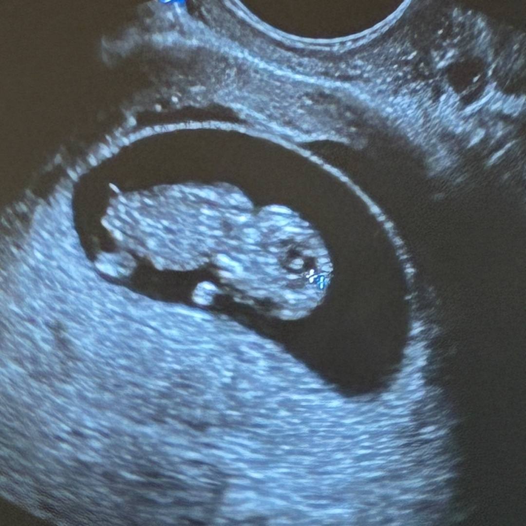 Photo shared by Alyssia for their Babylist baby registry.