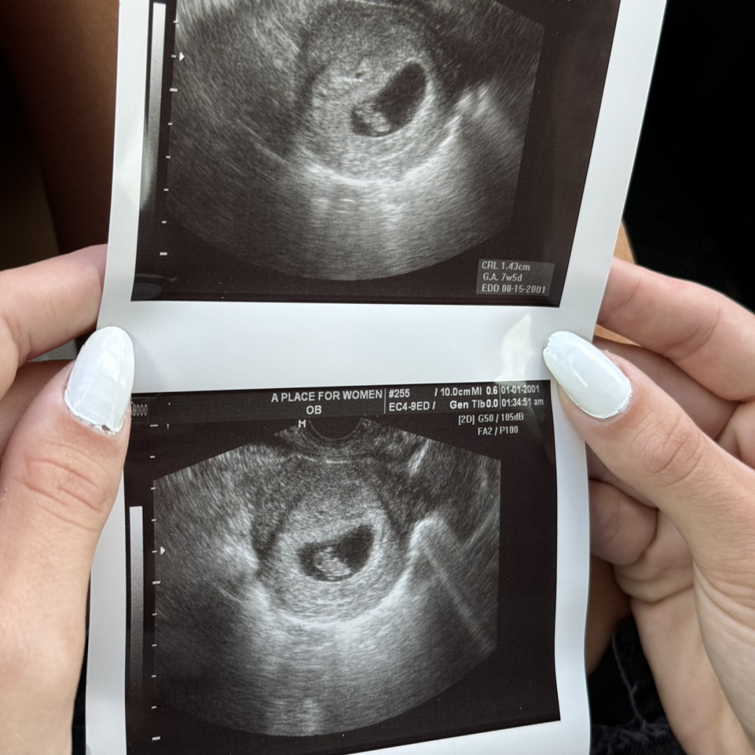 Photo shared by Makayla for their Babylist baby registry.