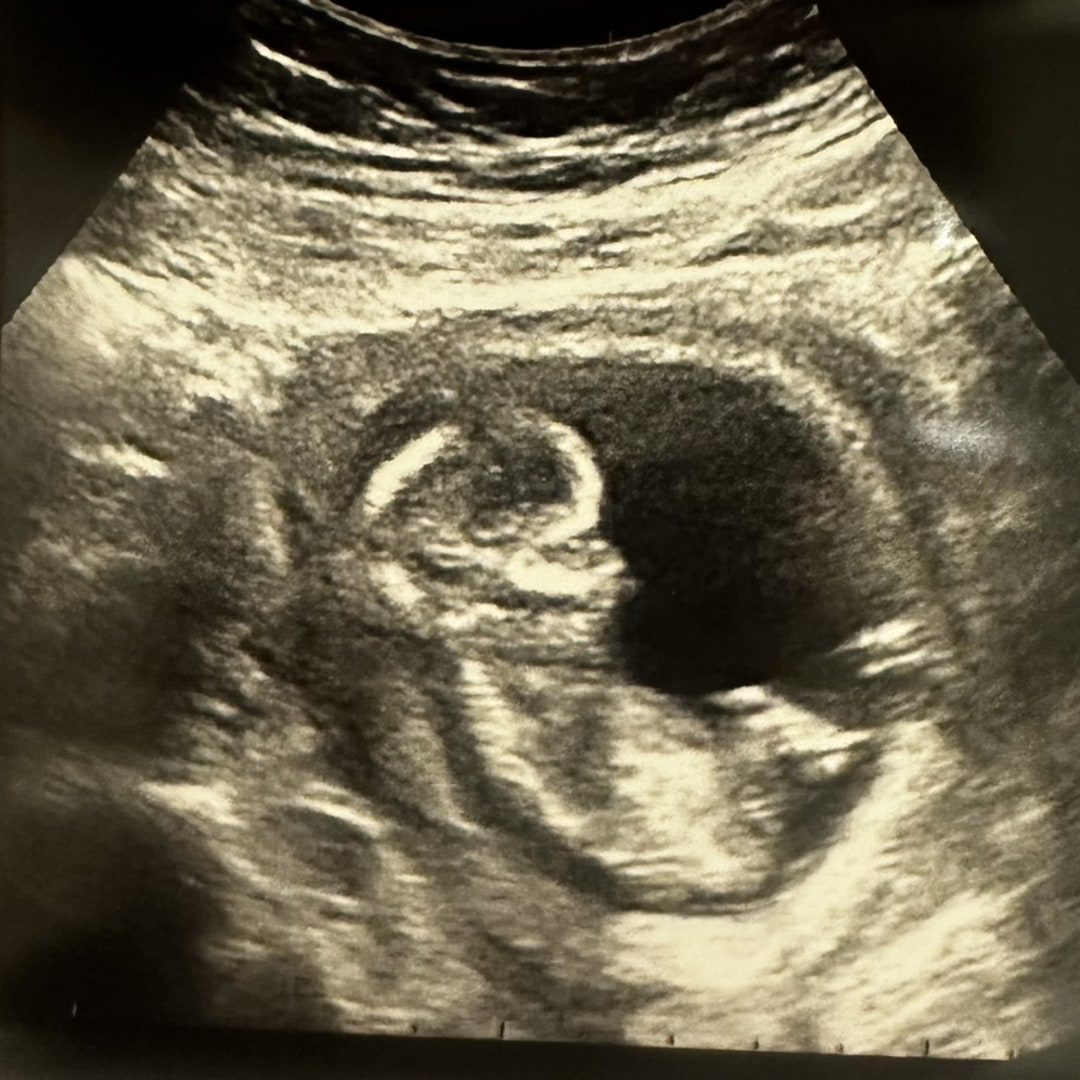 Photo shared by Chelsea for their Babylist baby registry.