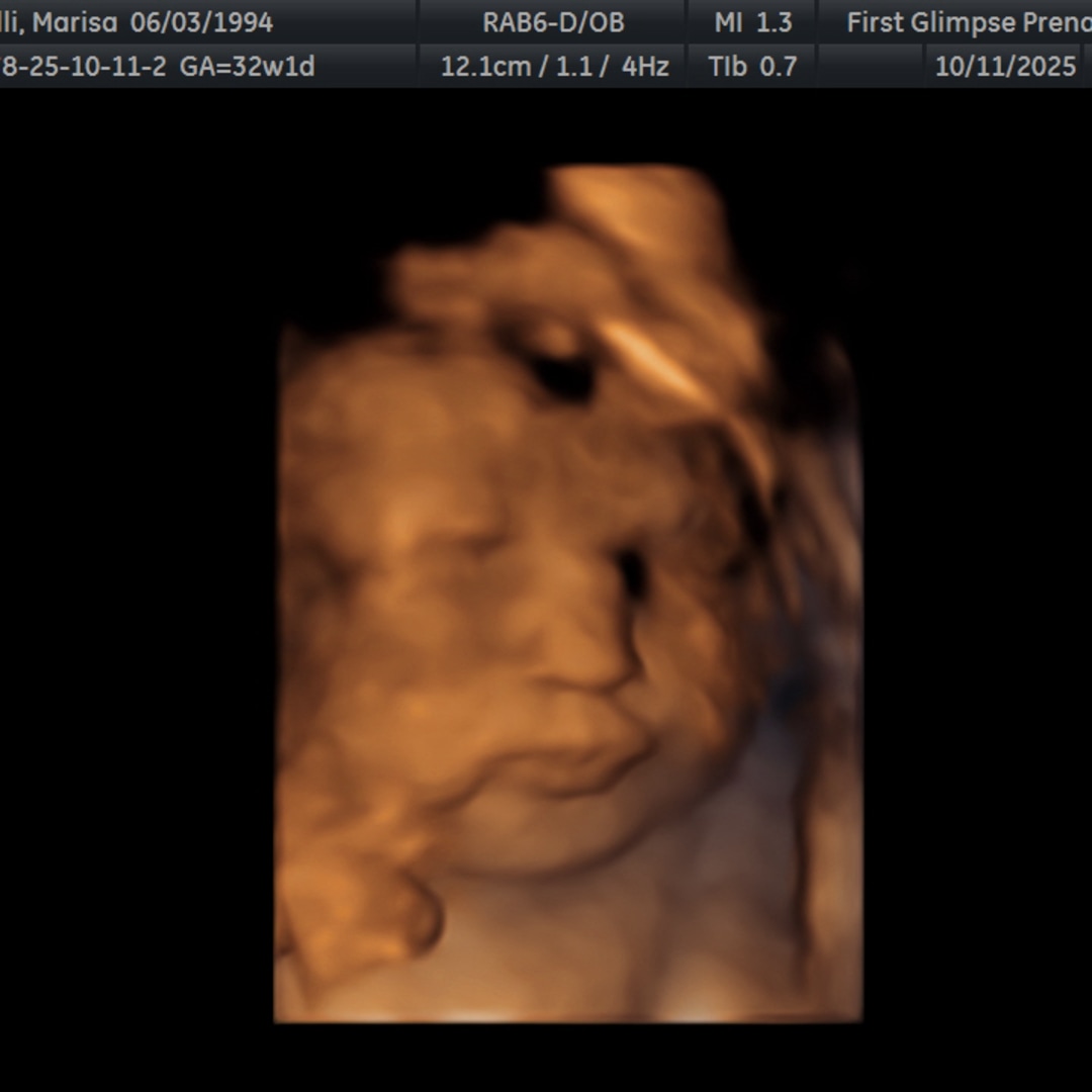 Photo shared by Marisa for their Babylist baby registry.