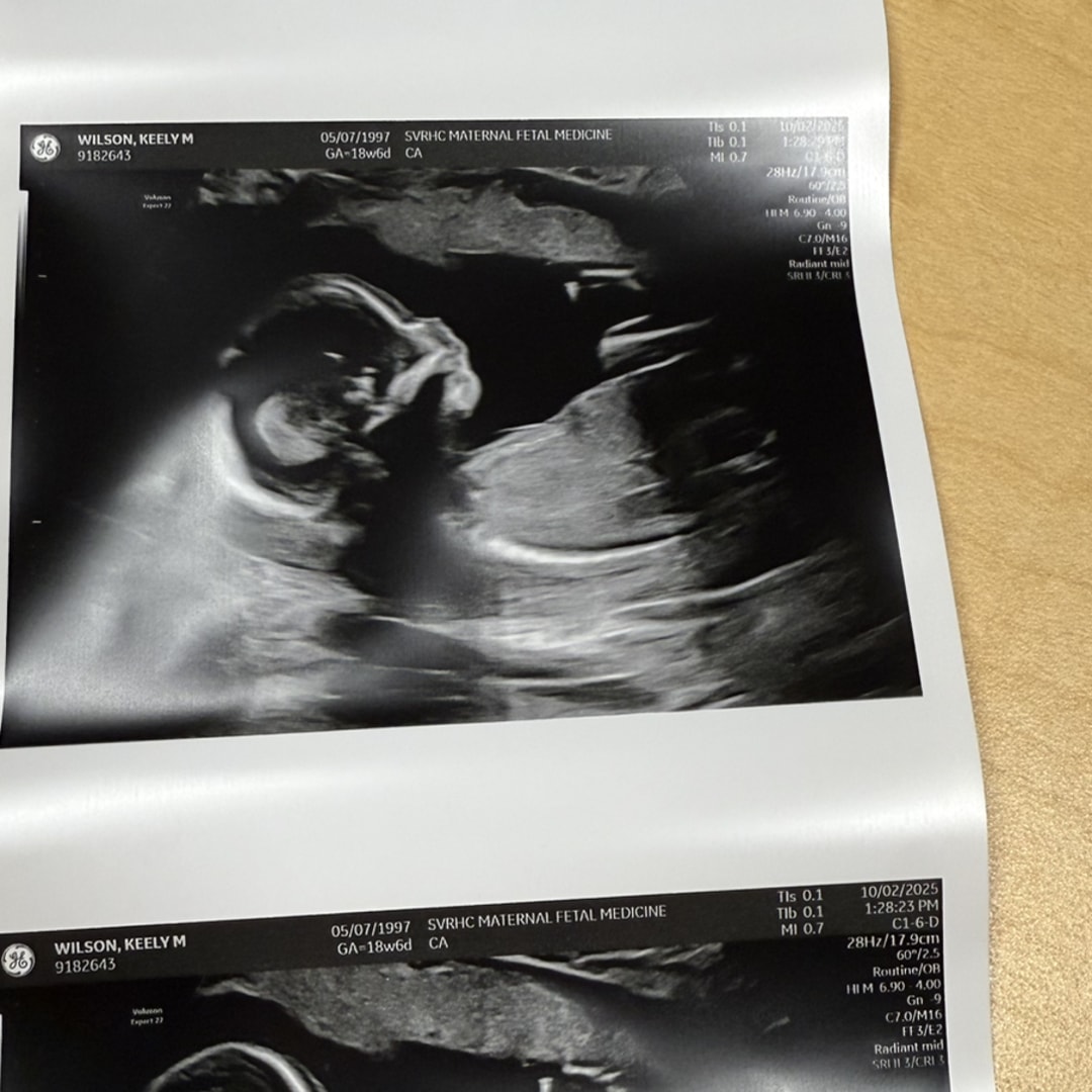 Photo shared by Keely for their Babylist baby registry.