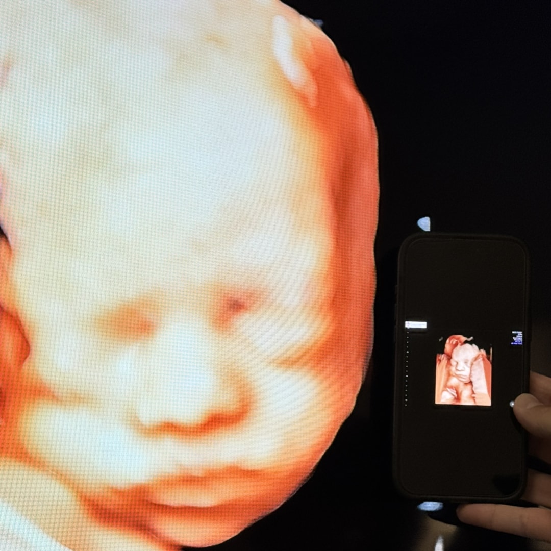 Photo shared by Raquel for their Babylist baby registry.