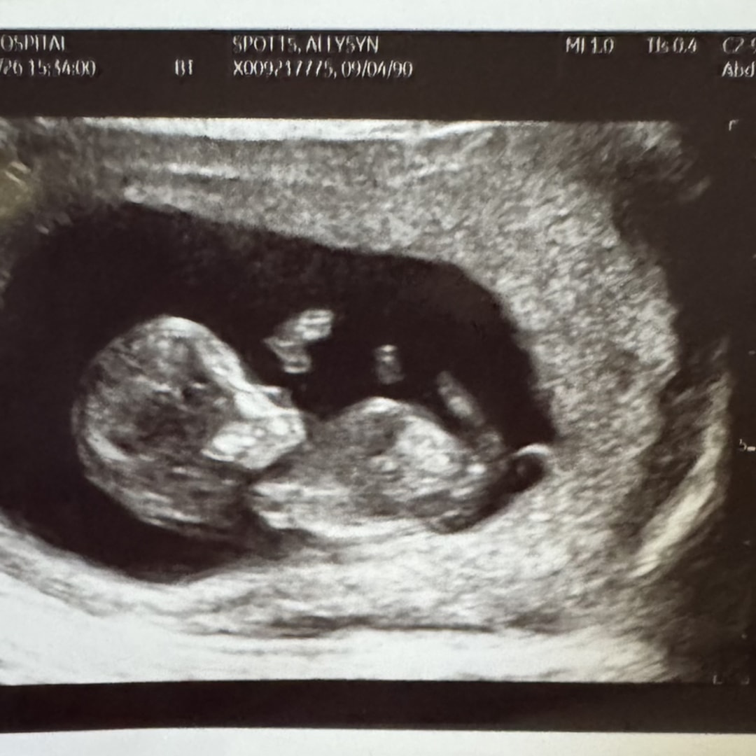 Photo shared by Allysyn for their Babylist baby registry.