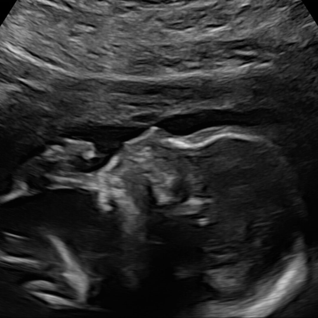 Photo shared by Kaitlin for their Babylist baby registry.